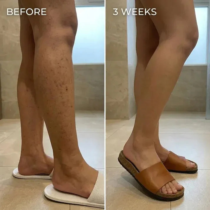 Cyperus Rotundus Hair Removal Oil | Buy1 Get1 Free